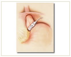 Slider image (2) Panama Gastric Surgery Center